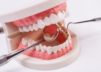 Exploring the Connection Between Periodontal Health and Dental Implants