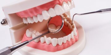 Exploring the Connection Between Periodontal Health and Dental Implants