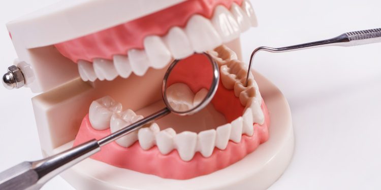 Exploring the Connection Between Periodontal Health and Dental Implants