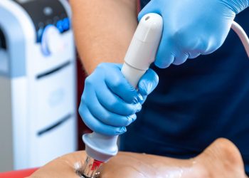 Say Goodbye to Varicose Veins: How Radiofrequency Ablation (RFA) Is Changing the Game