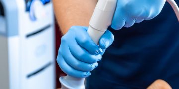 Say Goodbye to Varicose Veins: How Radiofrequency Ablation (RFA) Is Changing the Game